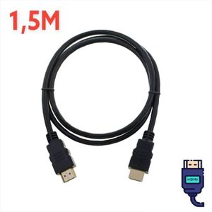 Sans Marque Pack 2 Câble JACK vers 3 RCA - Audio&vidéo - 1.5 mètres à prix  pas cher